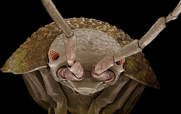 平甲鼠妇  郁康 显微镜